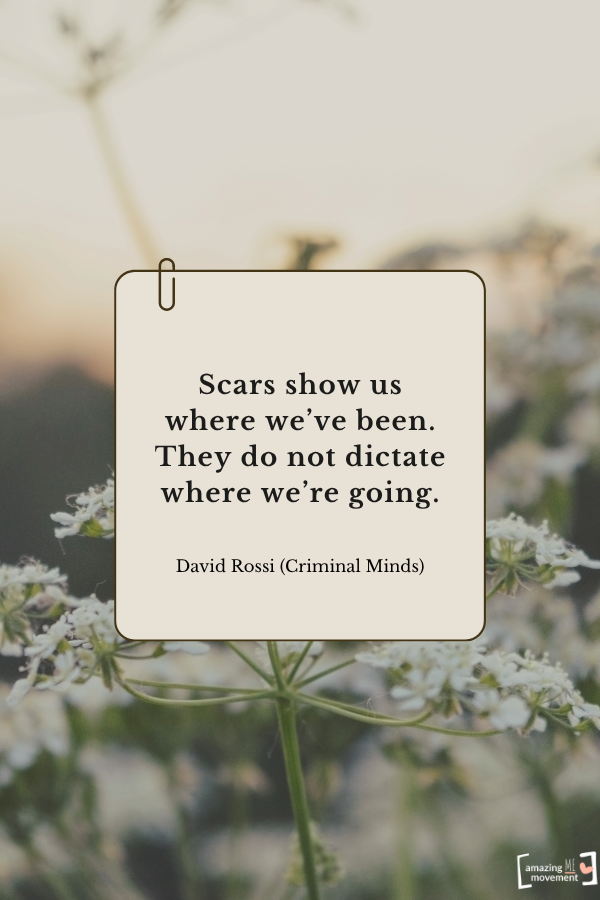 Scars show us where we’ve been. They do not dictate where we’re going. — David Rossi (Criminal Minds)